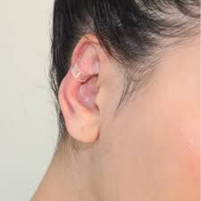 CORRECTOR DE OREJAS